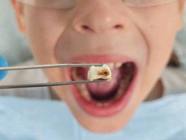 Best Emergency Dental Surgery in Peotone, IL